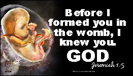 Before I Formed You in the Womb I Knew You (Fetus) Business Card